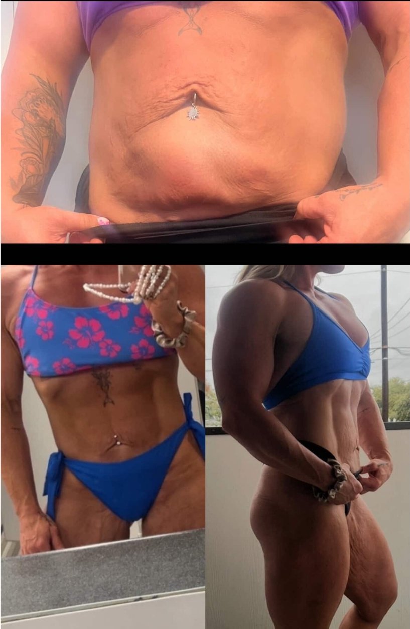 Combo Treatment Result